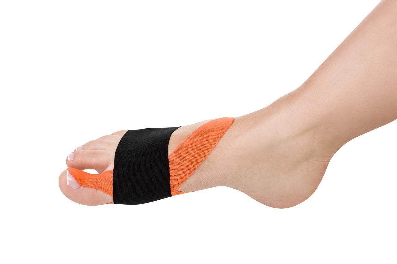 1902394121_kinezio-strichka-pri Кинезио стрічка при вальгусной деформації Qmed Kinesio tape - Зображення 1